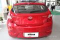 2014款 1.4L 自動(dòng)TOP